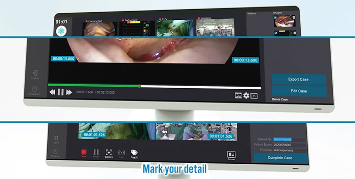 MEDIRECO| Medical Video Recorder